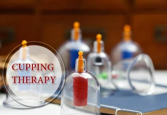 HIJAMA (CUPPING) THERAPY